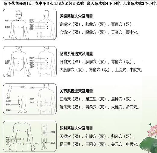 2026年三伏贴三伏天贴敷已经开始了